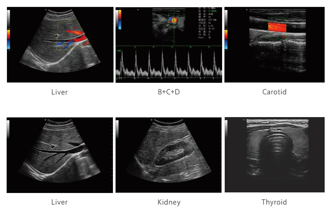 Portable Digital Color Doppler Ultrasound C50 - High Resolution Imaging for Medical Diagnosis
