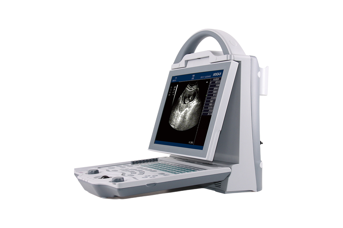 Customizable KX5600 Medical Ultrasound Equipment with Large Capacity Li-Battery Power Supply