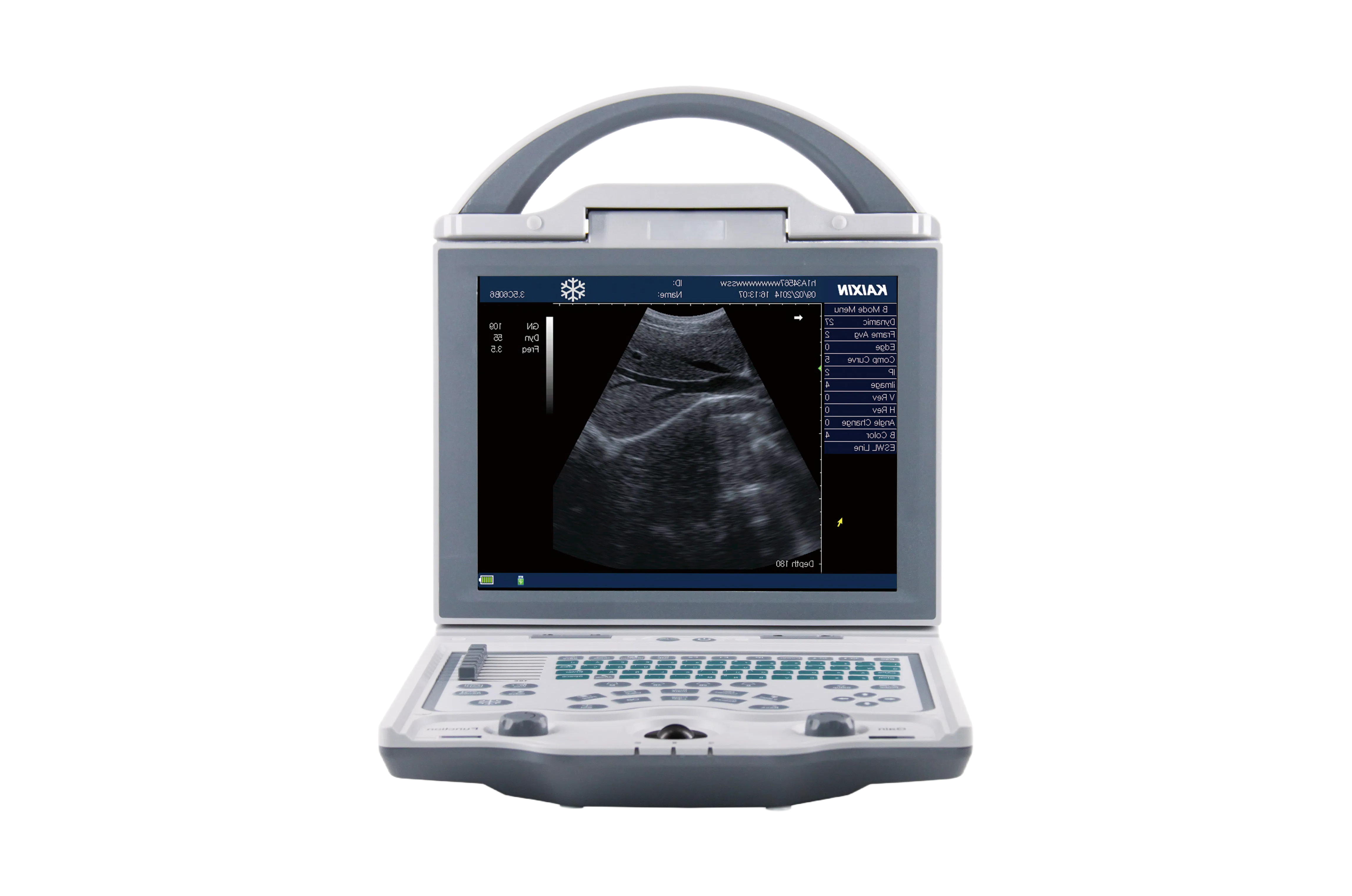 Customizable KX5600 Medical Ultrasound Equipment with Large Capacity Li-Battery Power Supply