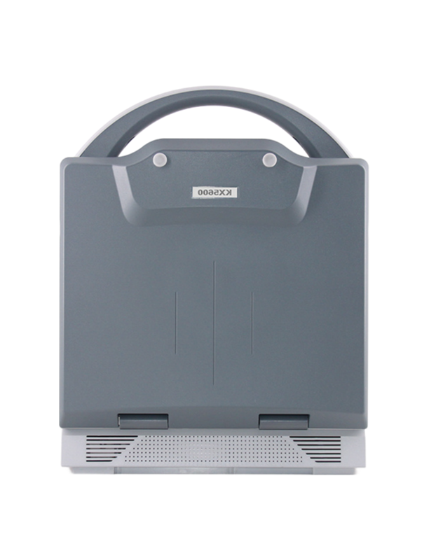 Customizable KX5600 Medical Ultrasound Equipment with Large Capacity Li-Battery Power Supply