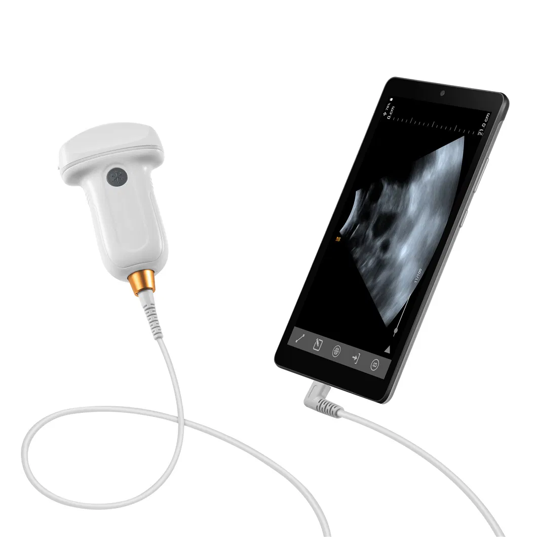 MX5 Intelligent Ultrasound Probe - 160° Scan Angle for Pig Follicular Development Tracking
