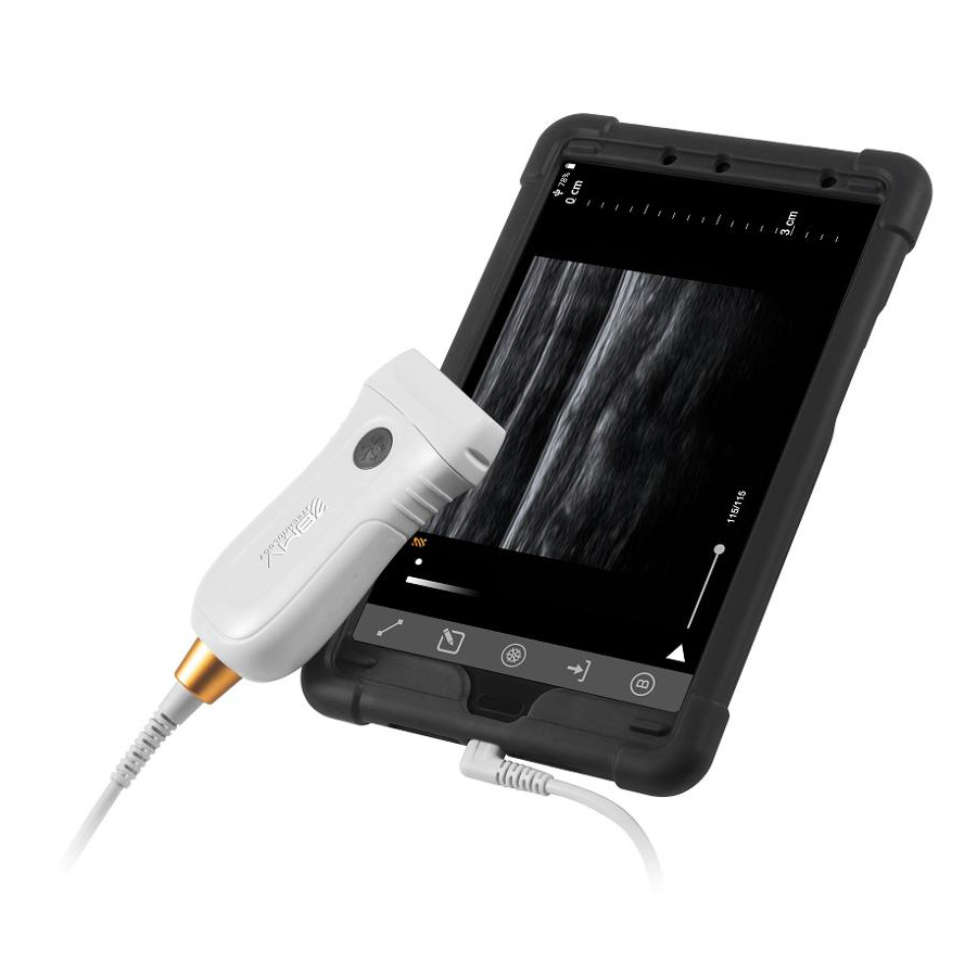 MX5 Intelligent Ultrasound Probe - 160° Scan Angle for Pig Follicular Development Tracking