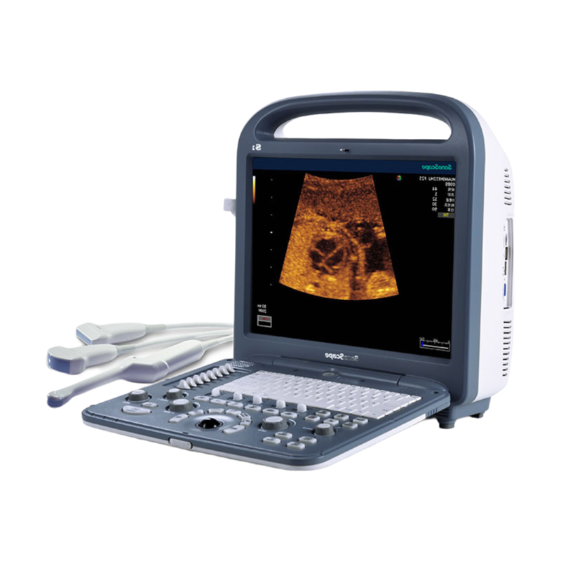 SonoScape S2 Portable Color Doppler Ultrasound System with 15-inch HD Monitor for Clinical Diagnosis