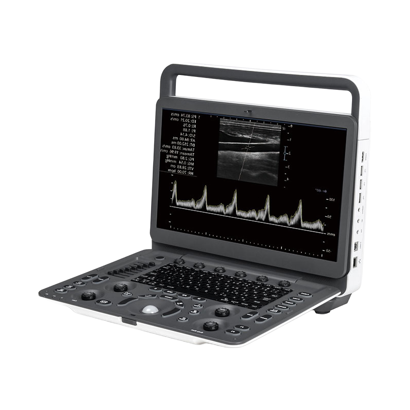 Sonoscape E1 Portable B/W Ultrasound System with 15.6