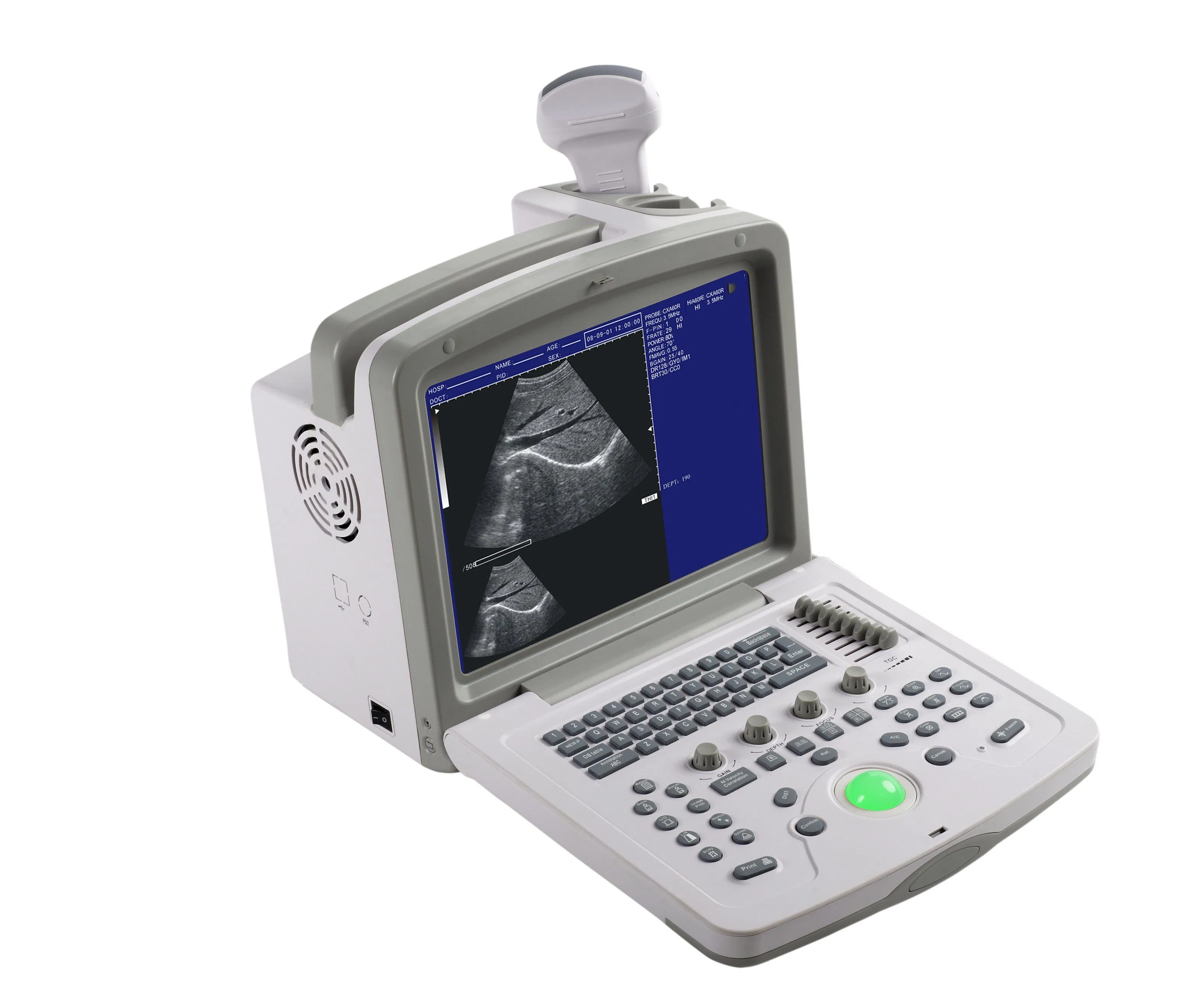 CE FDA Certified MS-9000AB Portable Ultrasound Device for OB/GYN Cardiology