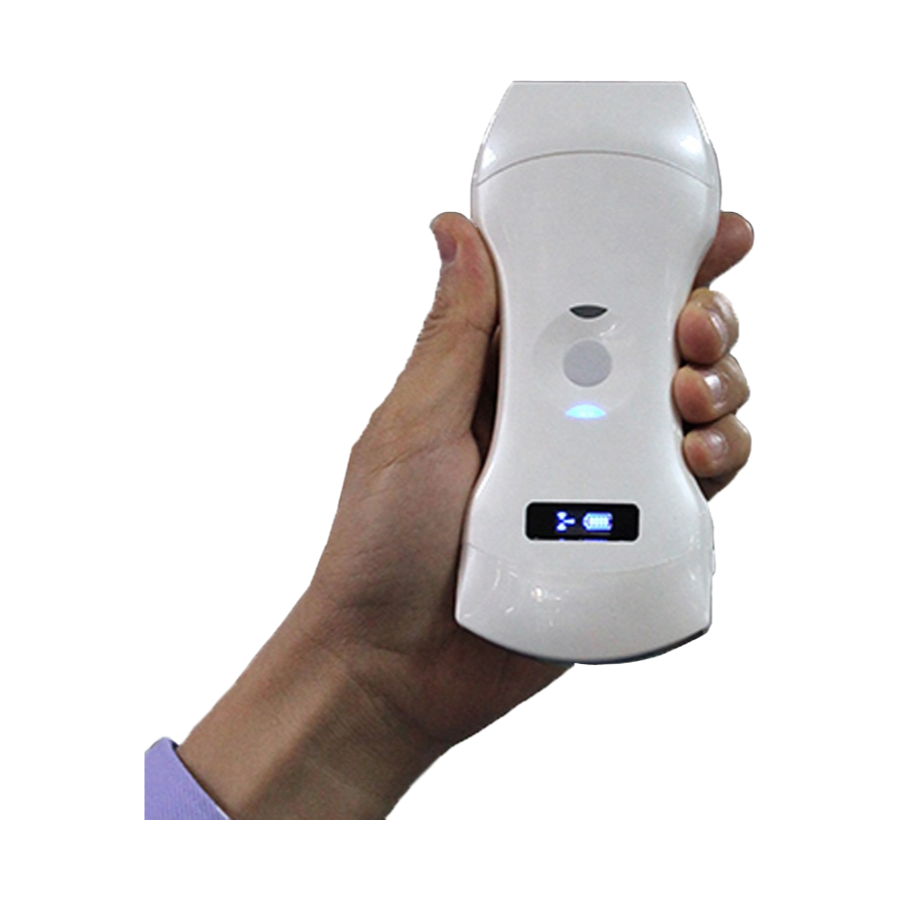 Portable Ultrasound Scanning Device with WiFi Connectivity for Hospital and Clinical Use