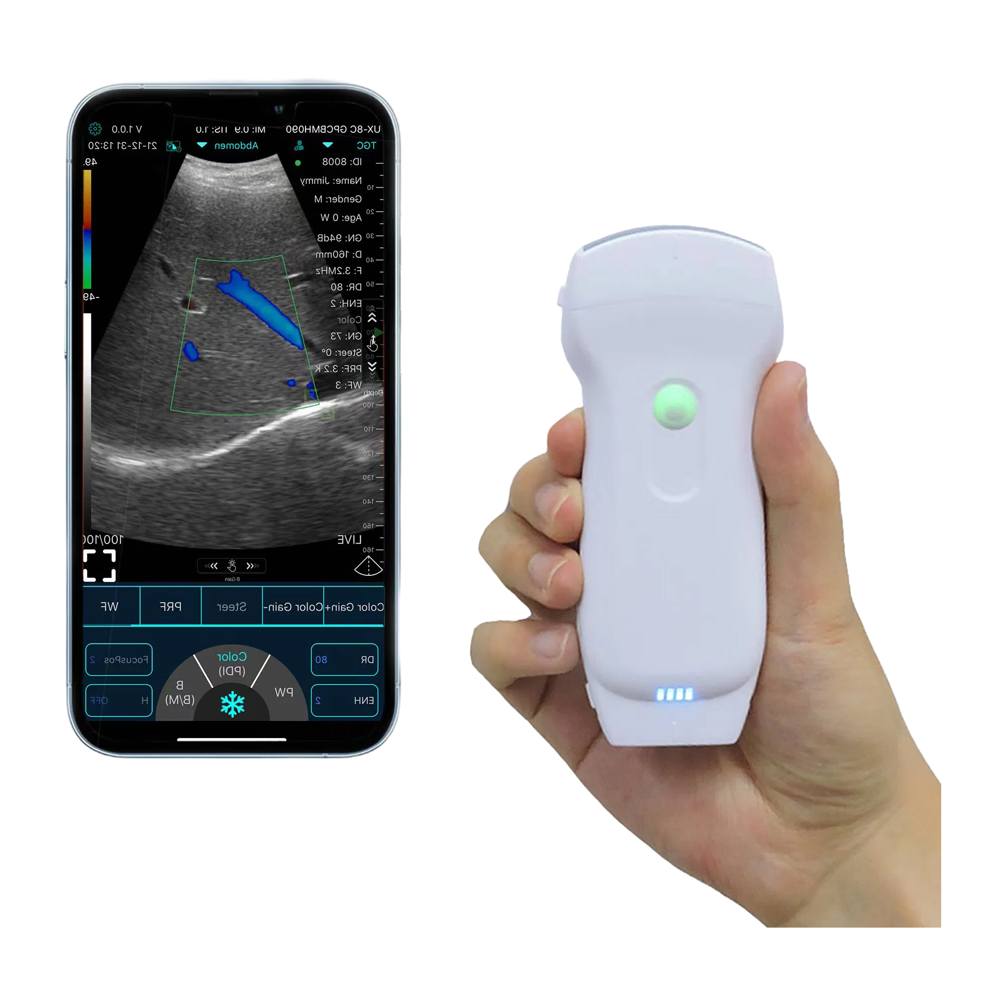 Factory Wholesale C10RL Ultrasound System with B/BM/Color/PDI/PW Modes, Electric Power & 2-Year Shelf Life for Medical Use