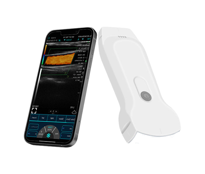 Factory Wholesale C10RL Ultrasound System with B/BM/Color/PDI/PW Modes, Electric Power & 2-Year Shelf Life for Medical Use