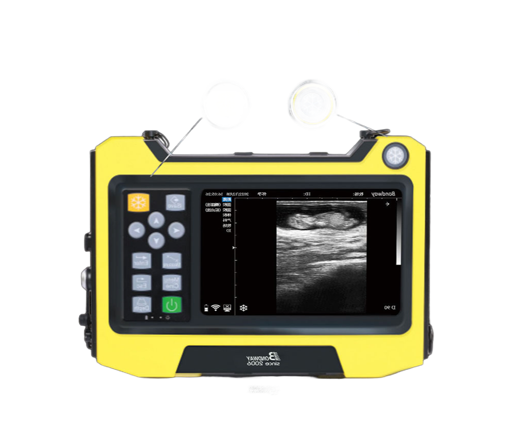 128-Element Transrectal Probe Veterinary Ultrasound Machine for Large Animals