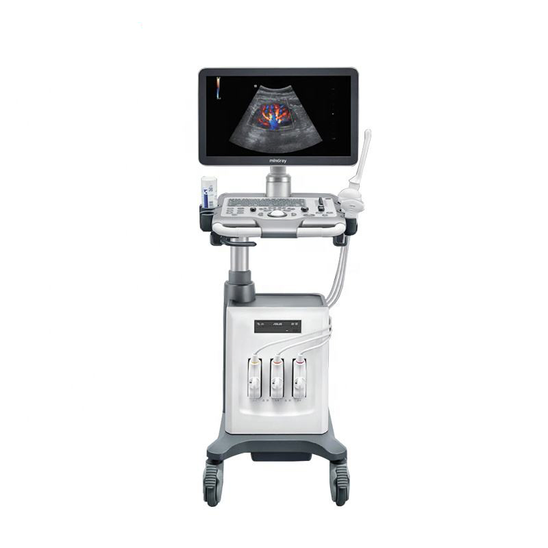 High Quality 3D 4D Trolley Color Doppler Ultrasound Machine with 21 Inch Display for Medical Diagnosis