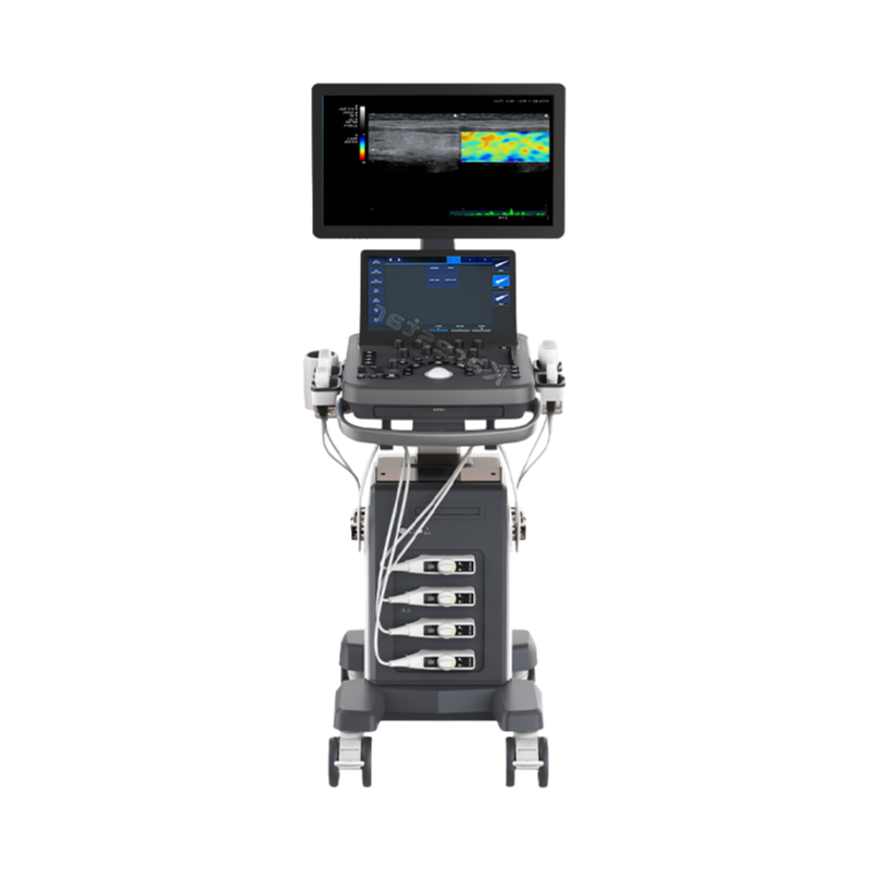High-Performance Hospital Trolley Ultrasound Machine with 21.5-Inch Monitor and Touch Screen