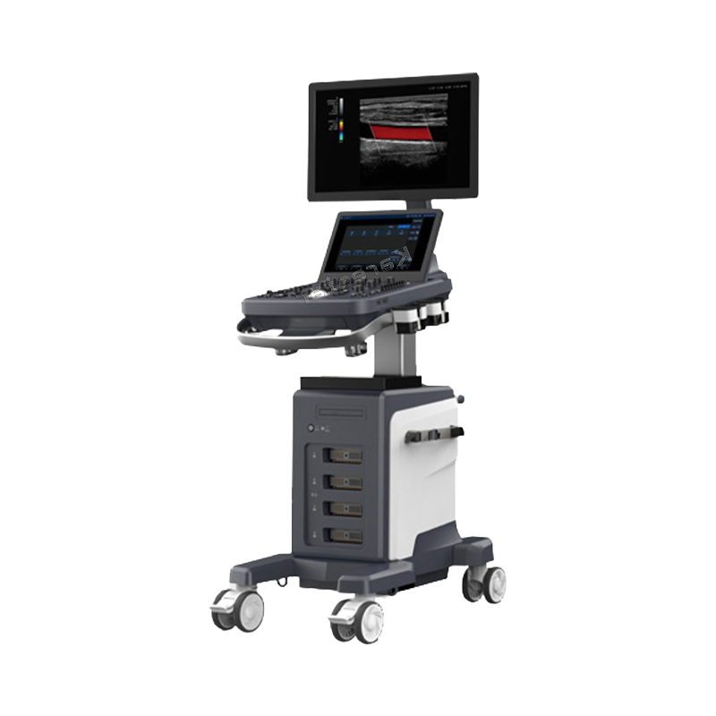 High-Performance Hospital Trolley Ultrasound Machine with 21.5-Inch Monitor and Touch Screen