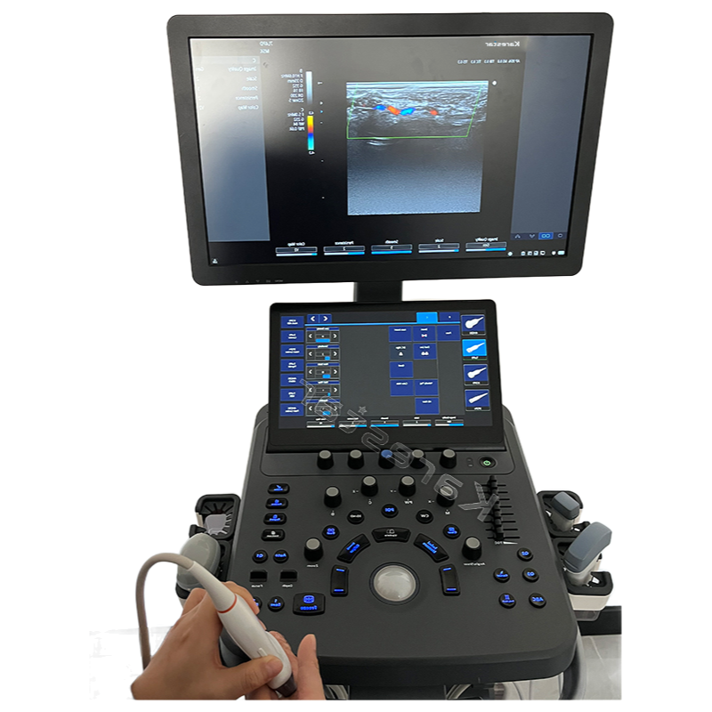 High-Performance Hospital Trolley Ultrasound Machine with 21.5-Inch Monitor and Touch Screen