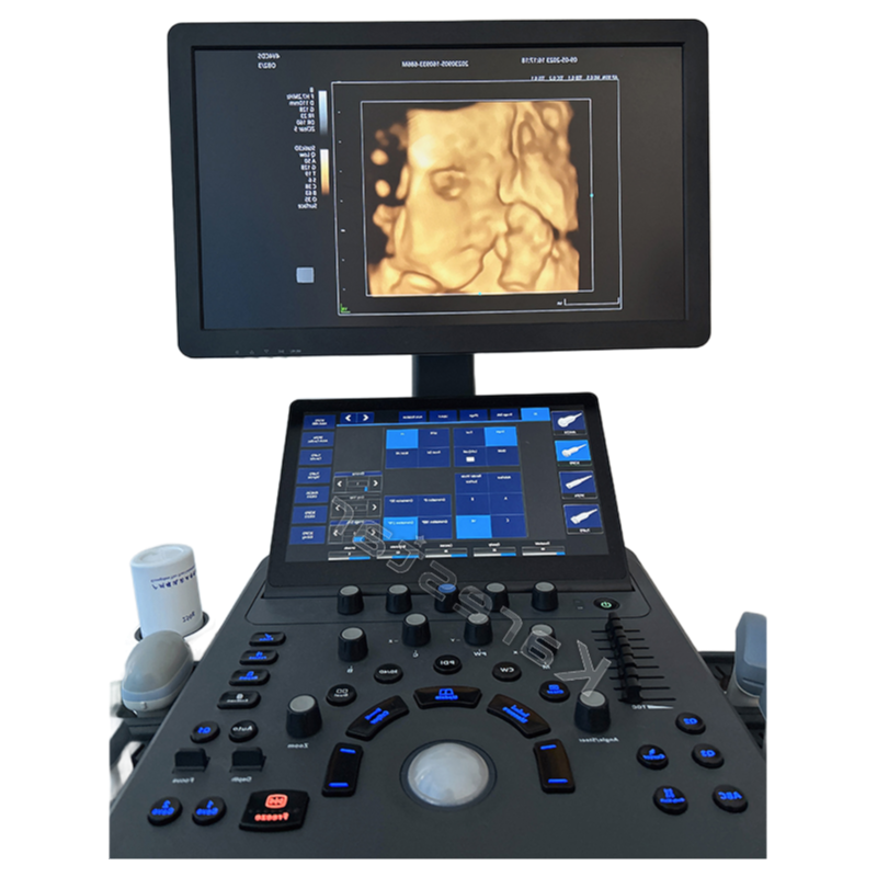 High-Performance Hospital Trolley Ultrasound Machine with 21.5-Inch Monitor and Touch Screen