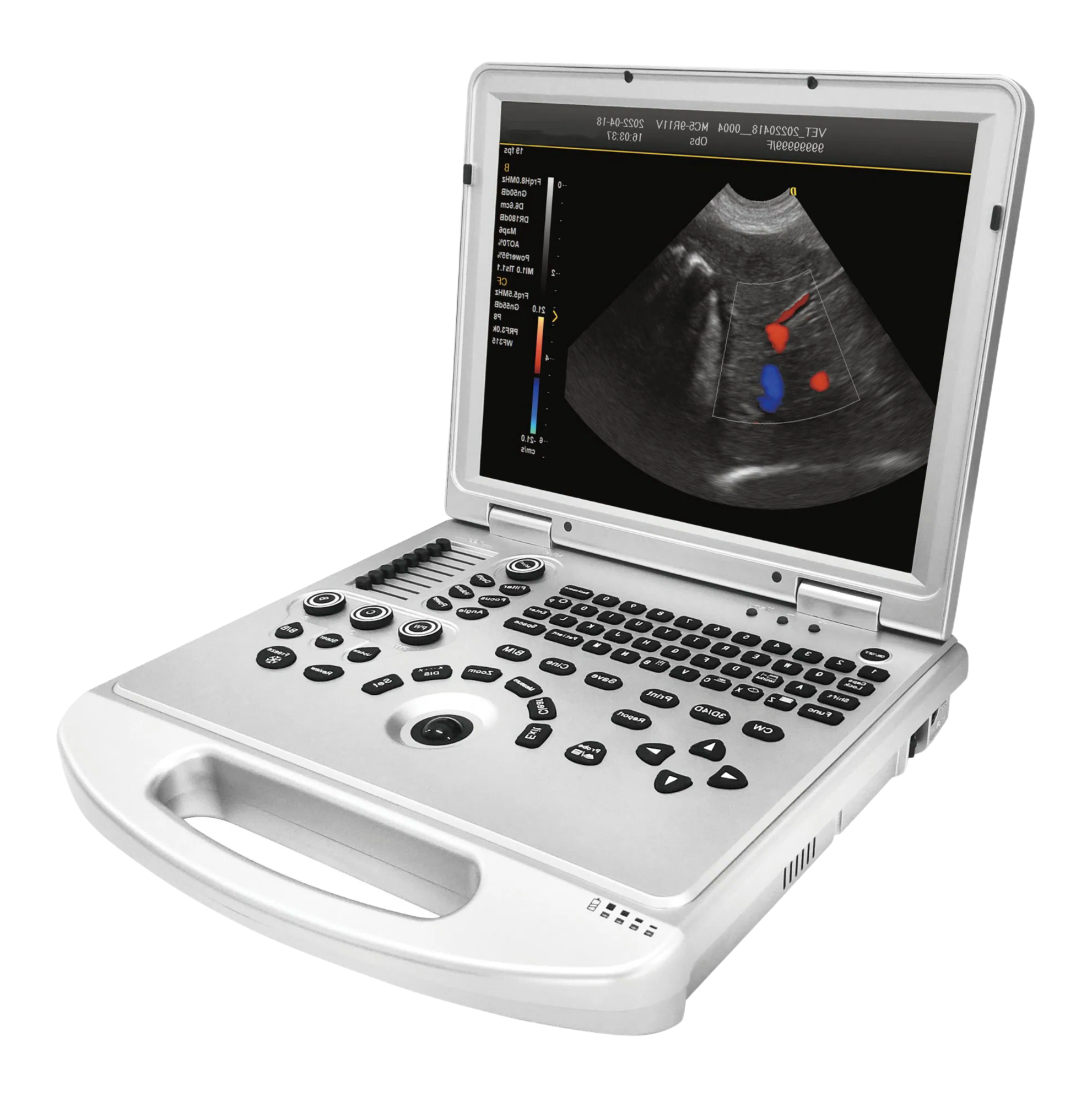 Customizable Veterinary Ultrasound Scanner with 6 Probe Options and DICOM 3.0 Protocol