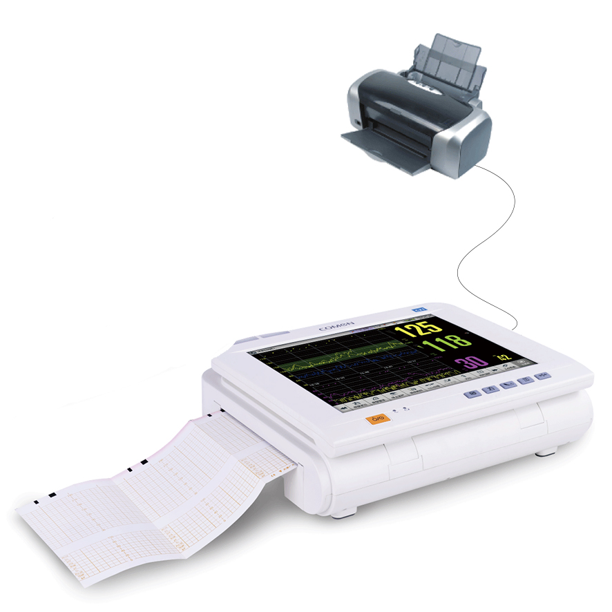 Compact Fetal Monitoring Equipment with 90° Folding Screen and Li-ion Battery Operation