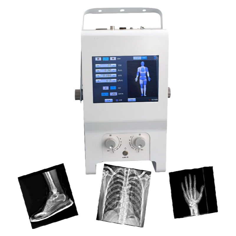Portable Digital X-Ray Machine for Hospitals - High Resolution Medical Imaging Equipment