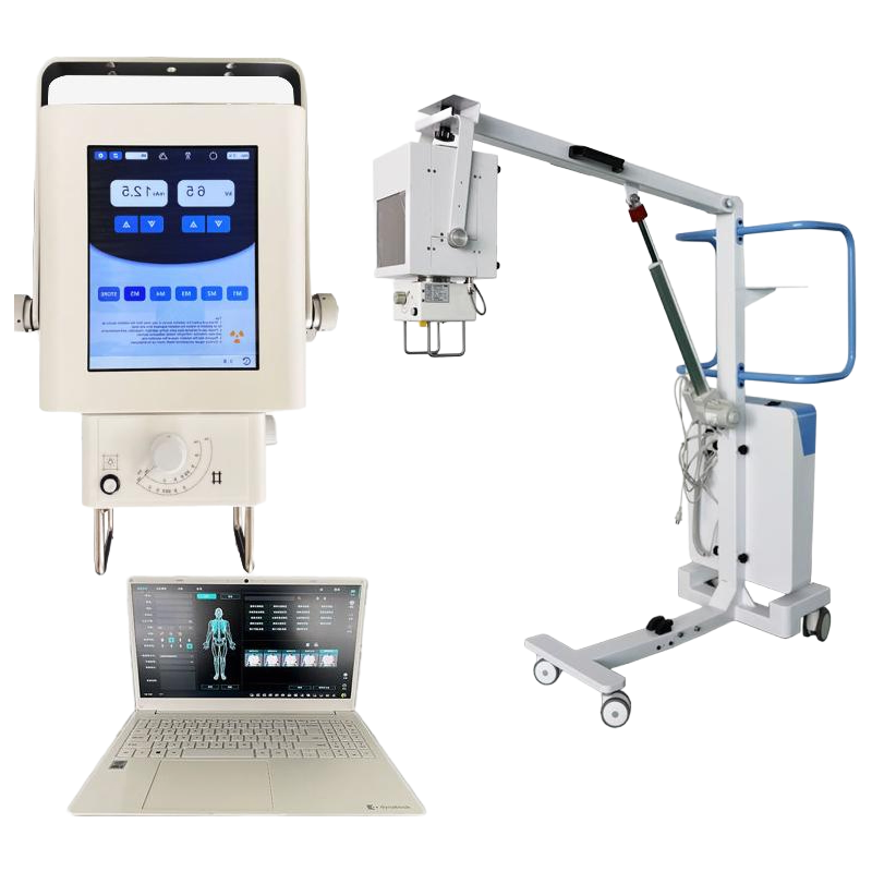 Portable Digital X-Ray Machine for Hospitals - High Resolution Medical Imaging Equipment