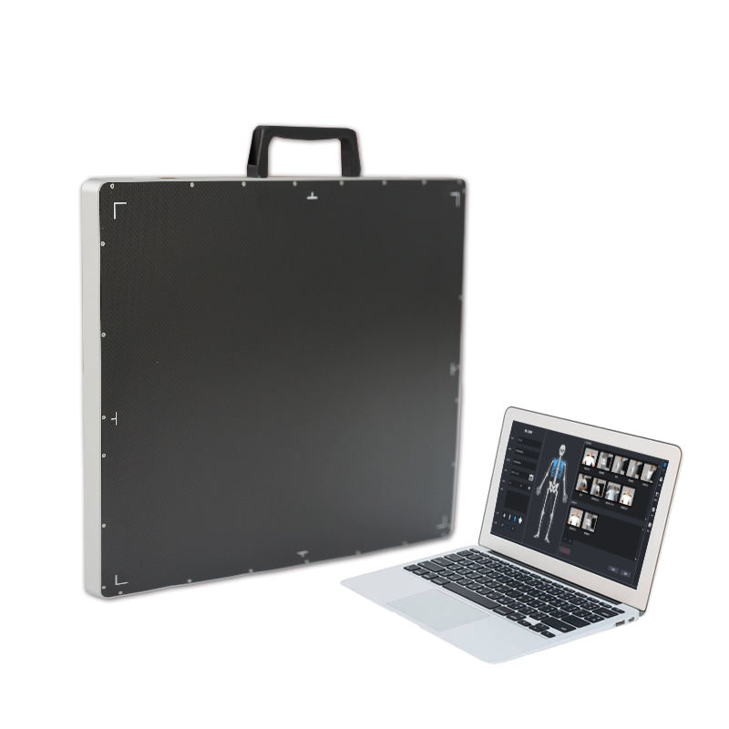 High Resolution Mobile X Ray Equipment for Hospitals and Clinics with CE FDA Certification