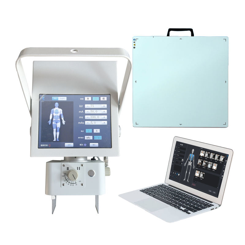 China Manufacturer Supply CE Certified Portable X Ray Machine for Medical Imaging