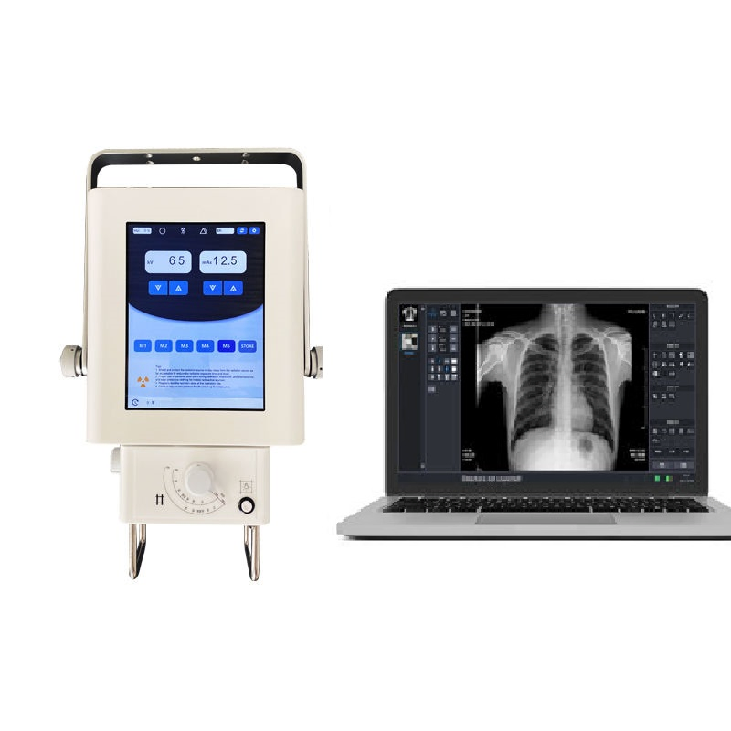 China Manufacturer Supply CE Certified Portable X Ray Machine for Medical Imaging