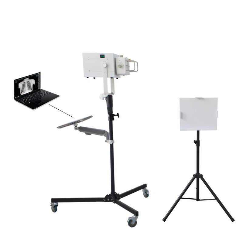 Professional Chest X-ray Machine for Emergency Rescue and Remote Medical Points