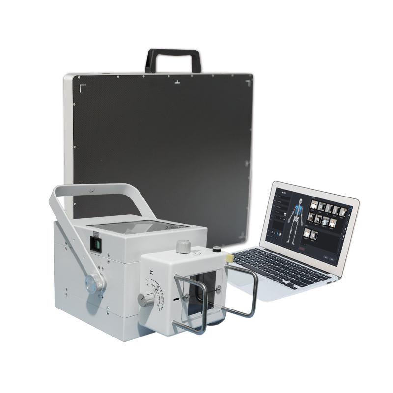 Professional Chest X-ray Machine for Emergency Rescue and Remote Medical Points