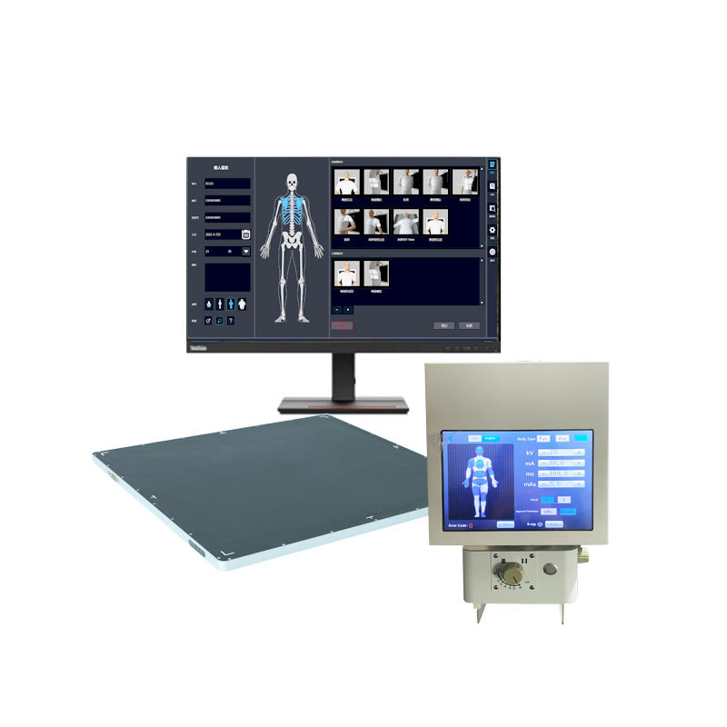 Professional Chest X-ray Machine for Emergency Rescue and Remote Medical Points