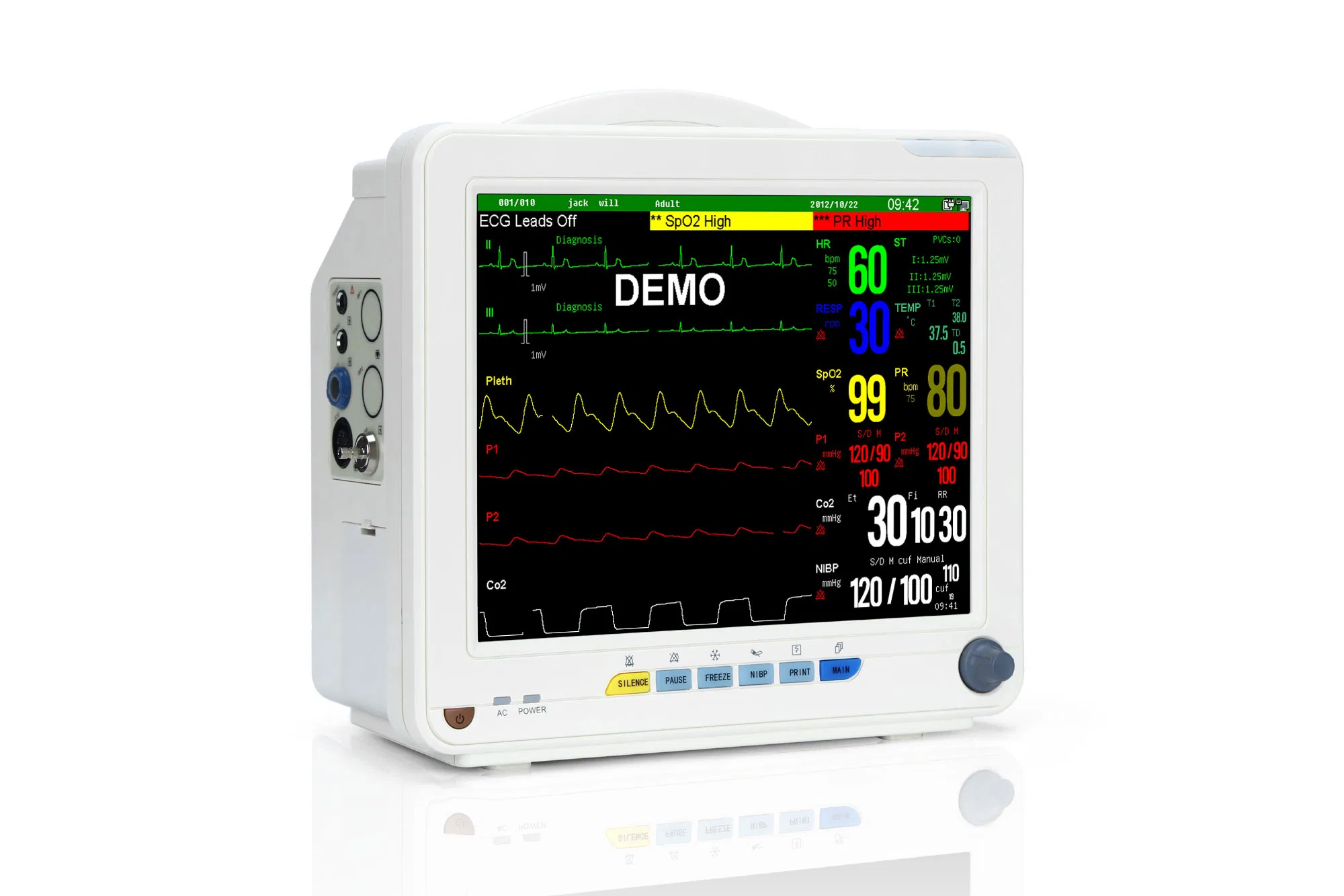 Customizable SNP9000N Hospital Patient Monitor with 6 Parameters and Multi-Language Support