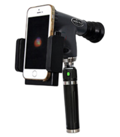 Portable Digital Ophthalmic Equipment with 5X Magnification for Fundus Imaging