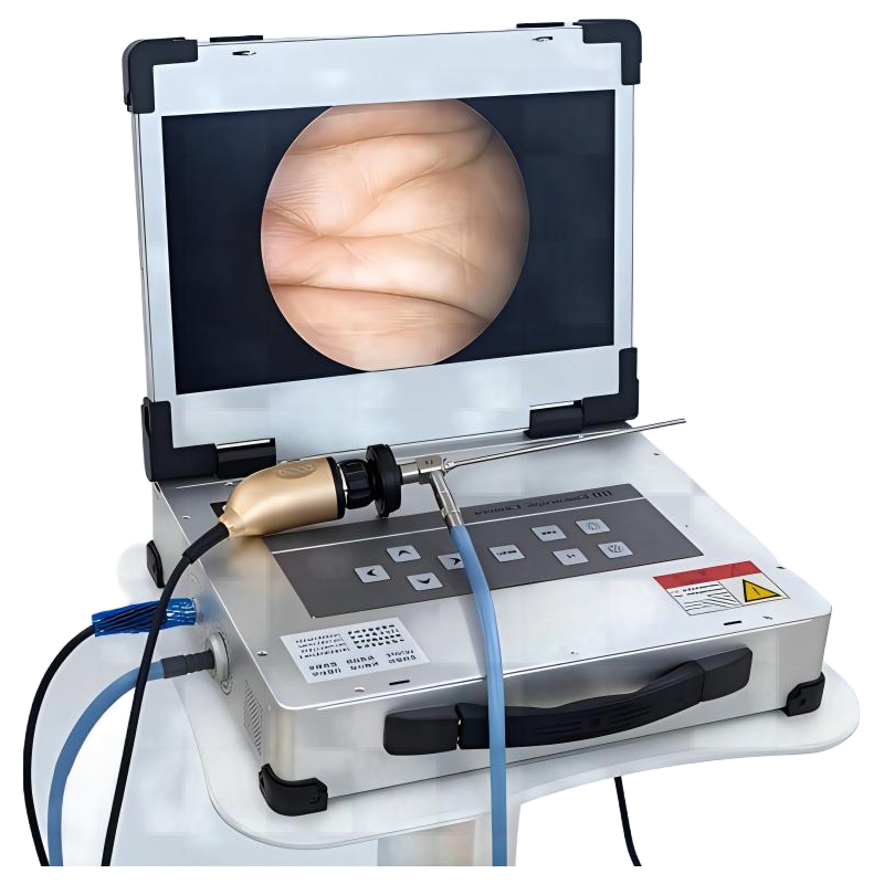 HD310 HD320 HD330 High Definition Medical Imaging System with 3G-SDI Output for Hospital Use