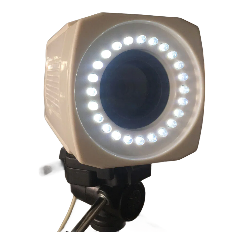 Professional Mobile Trolley-Type Colposcope with 800,000 Pixel Camera for Gynecology