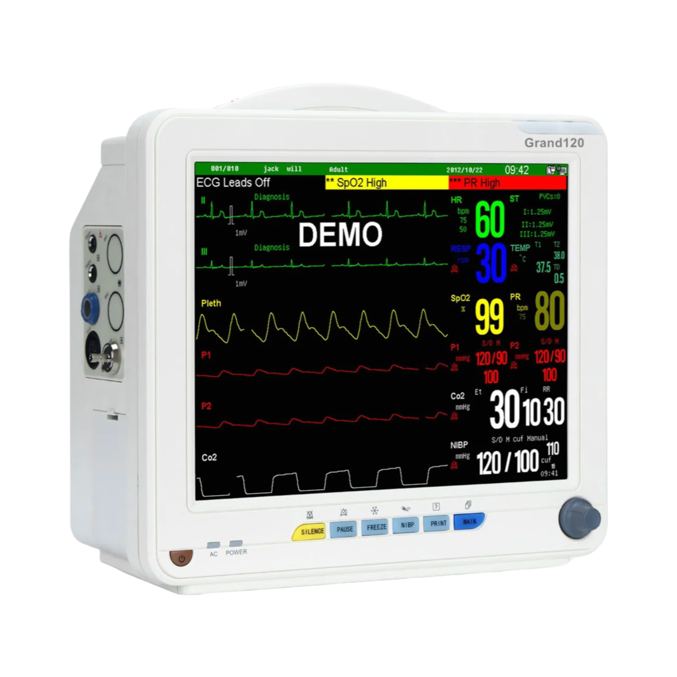 Customizable Hospital Patient Monitor with 4400mAh Battery and Wireless Connectivity Options