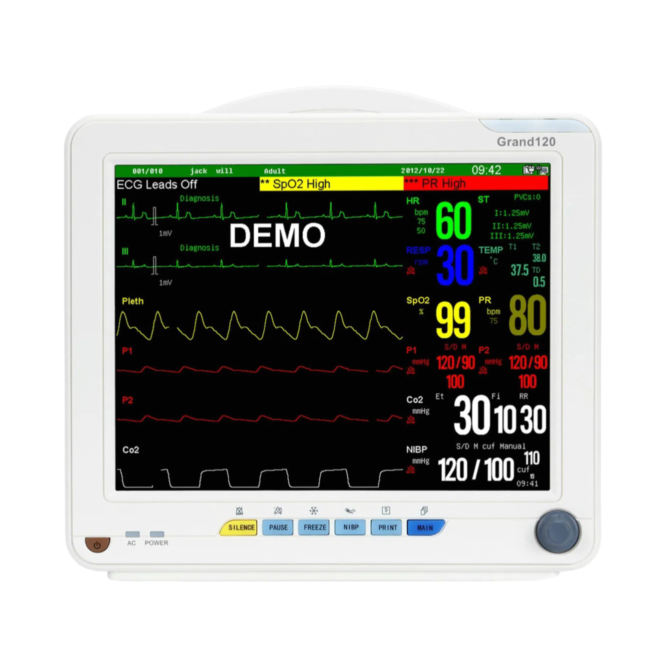 Customizable Hospital Patient Monitor with 4400mAh Battery and Wireless Connectivity Options