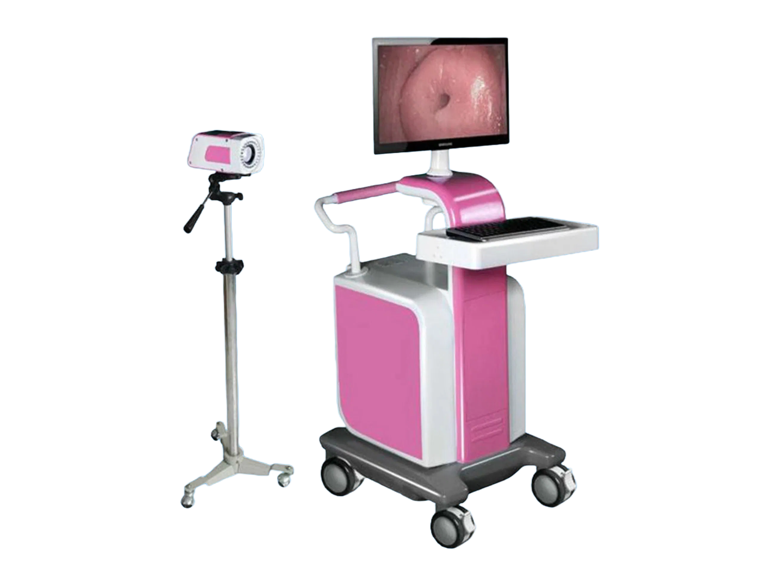 Advanced Computerized Colposcope with 800K Pixel Resolution for Cervical Examination