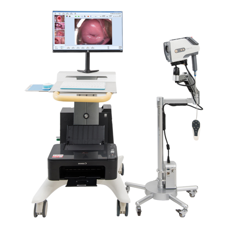 High Frame Rate Electronic Video Colposcope for Accurate Gynecological Imaging and Diagnosis
