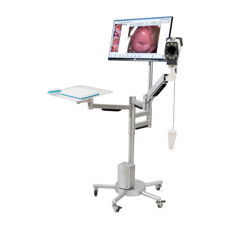 High Frame Rate Electronic Video Colposcope for Accurate Gynecological Imaging and Diagnosis