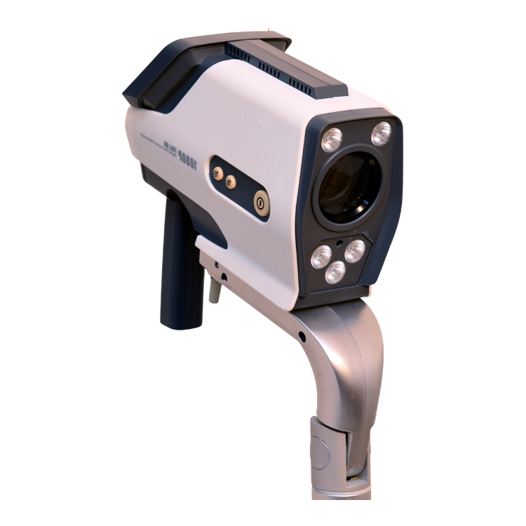 High Frame Rate Electronic Video Colposcope for Accurate Gynecological Imaging and Diagnosis
