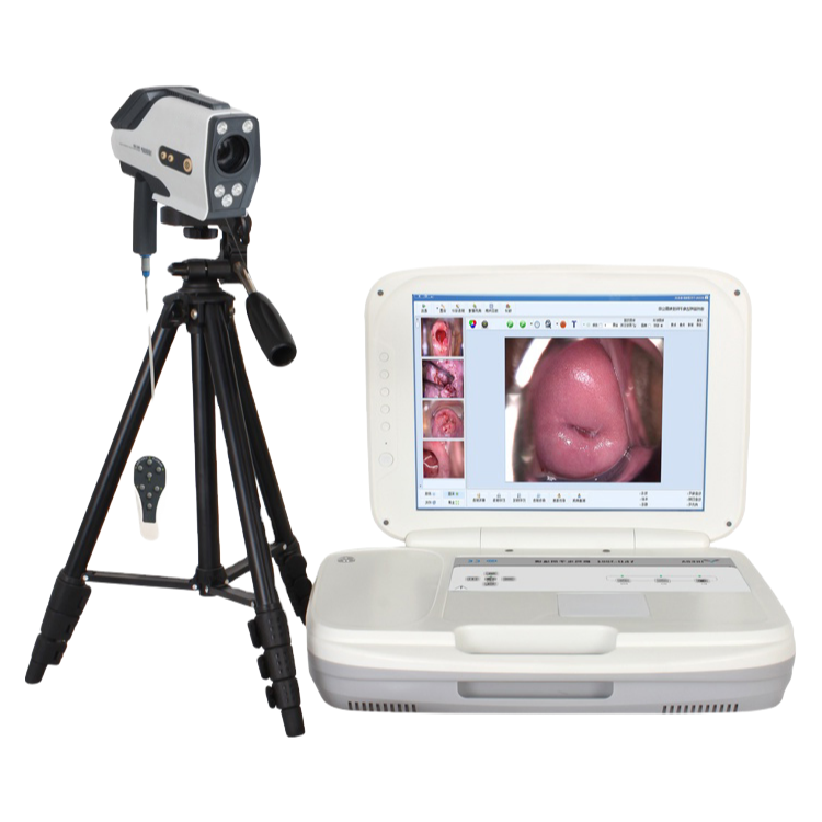 High Frame Rate Electronic Video Colposcope for Accurate Gynecological Imaging and Diagnosis