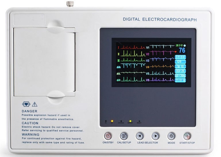 High Quality MY-H004B Portable ECG Machine with 0.05Hz~150Hz Frequency Response