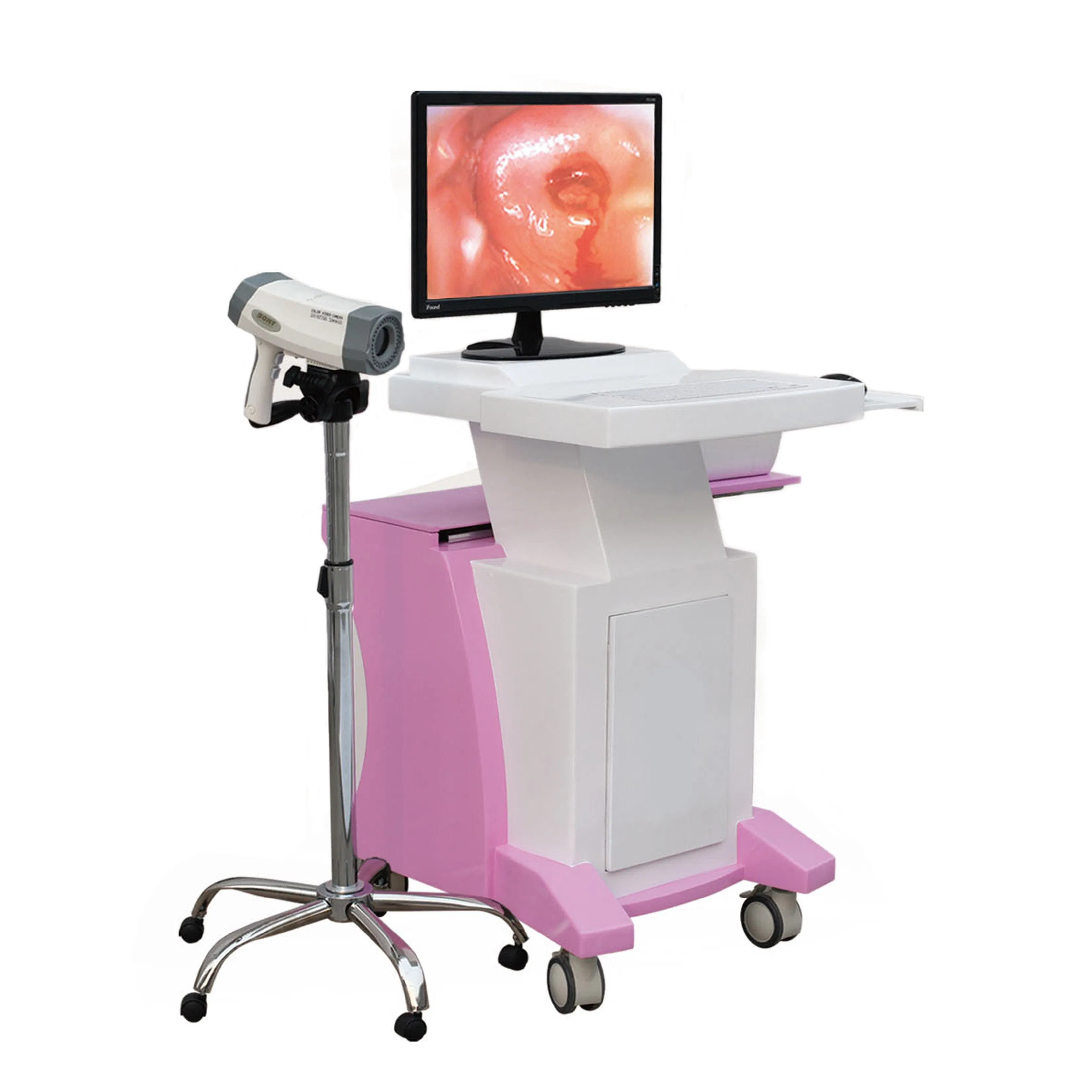 Wholesale IN-G8000C Gynecology Video Colposcope, Factory-Direct Customizable Digital Electronic Vagina Colposcope Camera with CE/FDA
