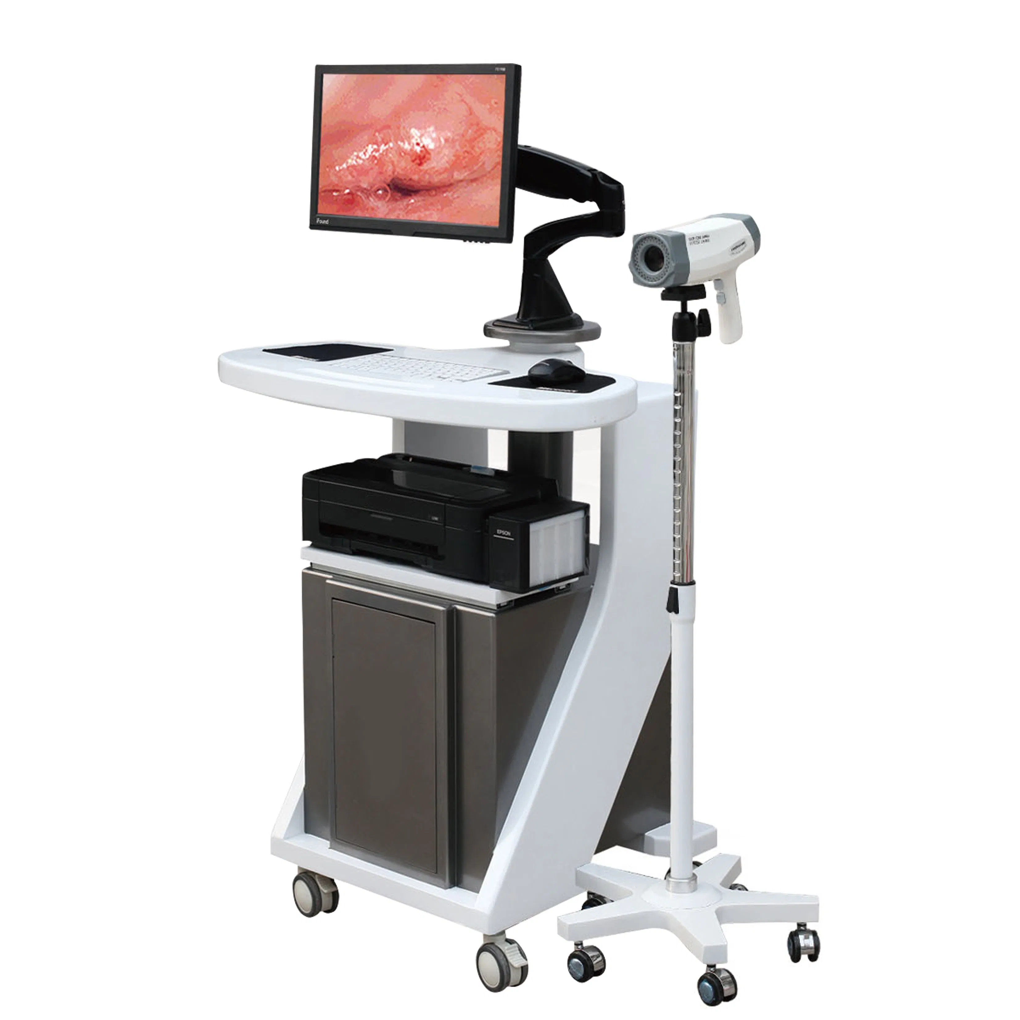 Wholesale IN-G8000C Gynecology Video Colposcope, Factory-Direct Customizable Digital Electronic Vagina Colposcope Camera with CE/FDA