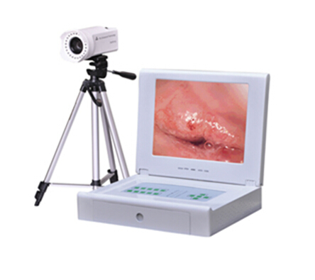 Portable Digital Electronic Colposcope with 800K Pixels CCD Camera for Cervical Examination