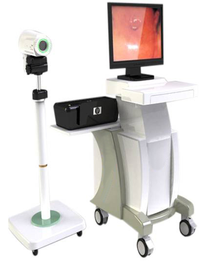 Portable Digital Electronic Colposcope with 800K Pixels CCD Camera for Cervical Examination