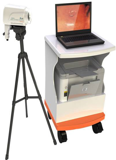Portable Digital Electronic Colposcope with 800K Pixels CCD Camera for Cervical Examination