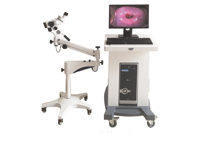 Portable Digital Electronic Colposcope with 800K Pixels CCD Camera for Cervical Examination