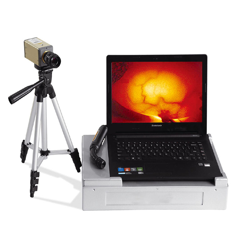 Full Digital Infrared Mammary Equipment Breast Diagnostic Test Kit for Medical Imaging