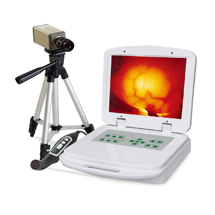 Full Digital Infrared Mammary Equipment Breast Diagnostic Test Kit for Medical Imaging