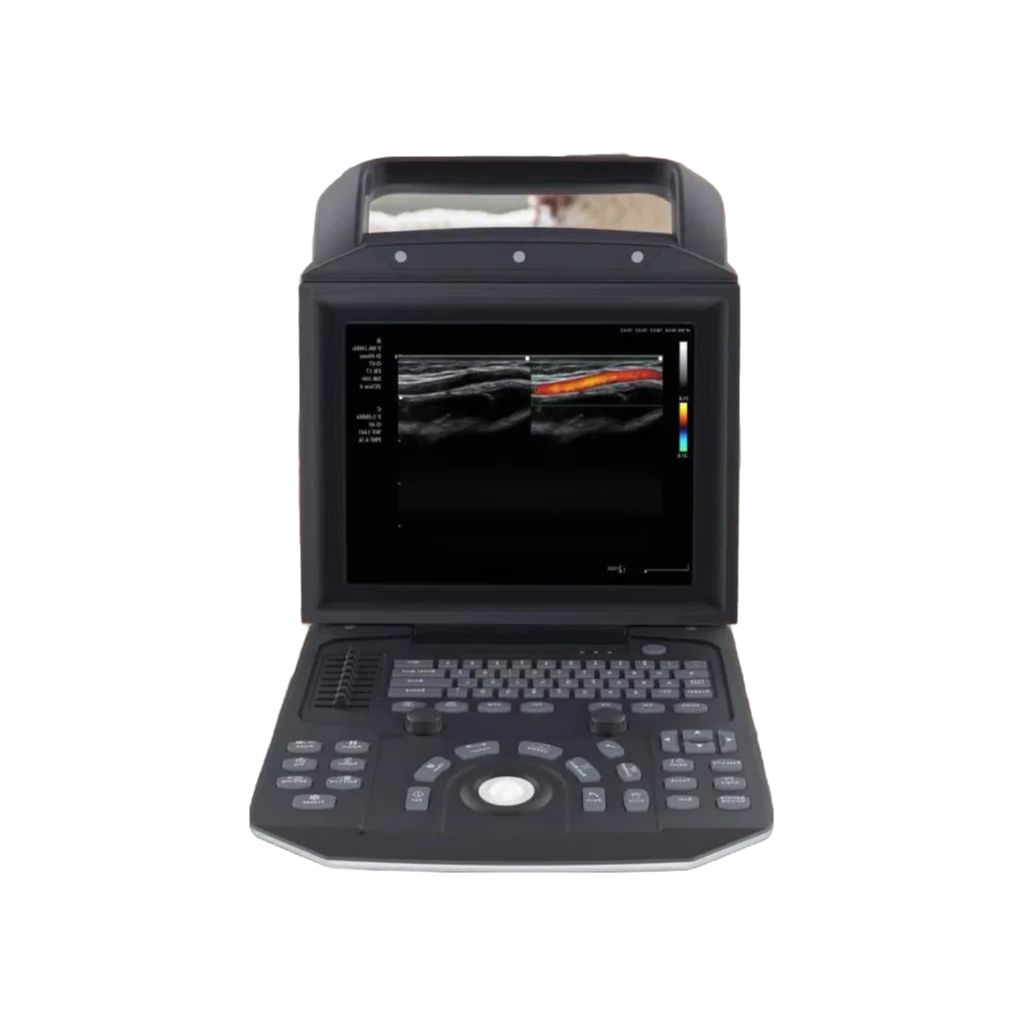 Customizable Animal Pregnancy Scanner with 12 Inch HD LED Monitor and Touch Screen