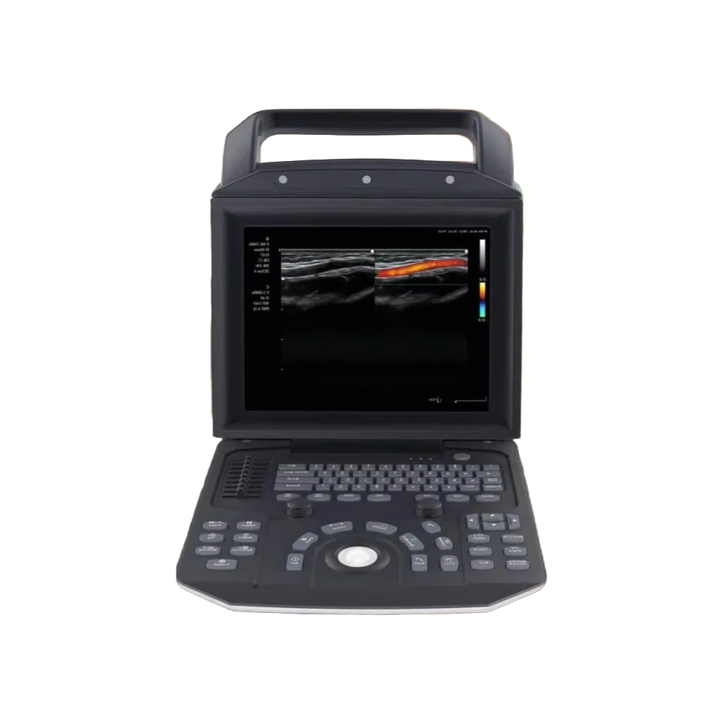 Customizable Animal Pregnancy Scanner with 12 Inch HD LED Monitor and Touch Screen